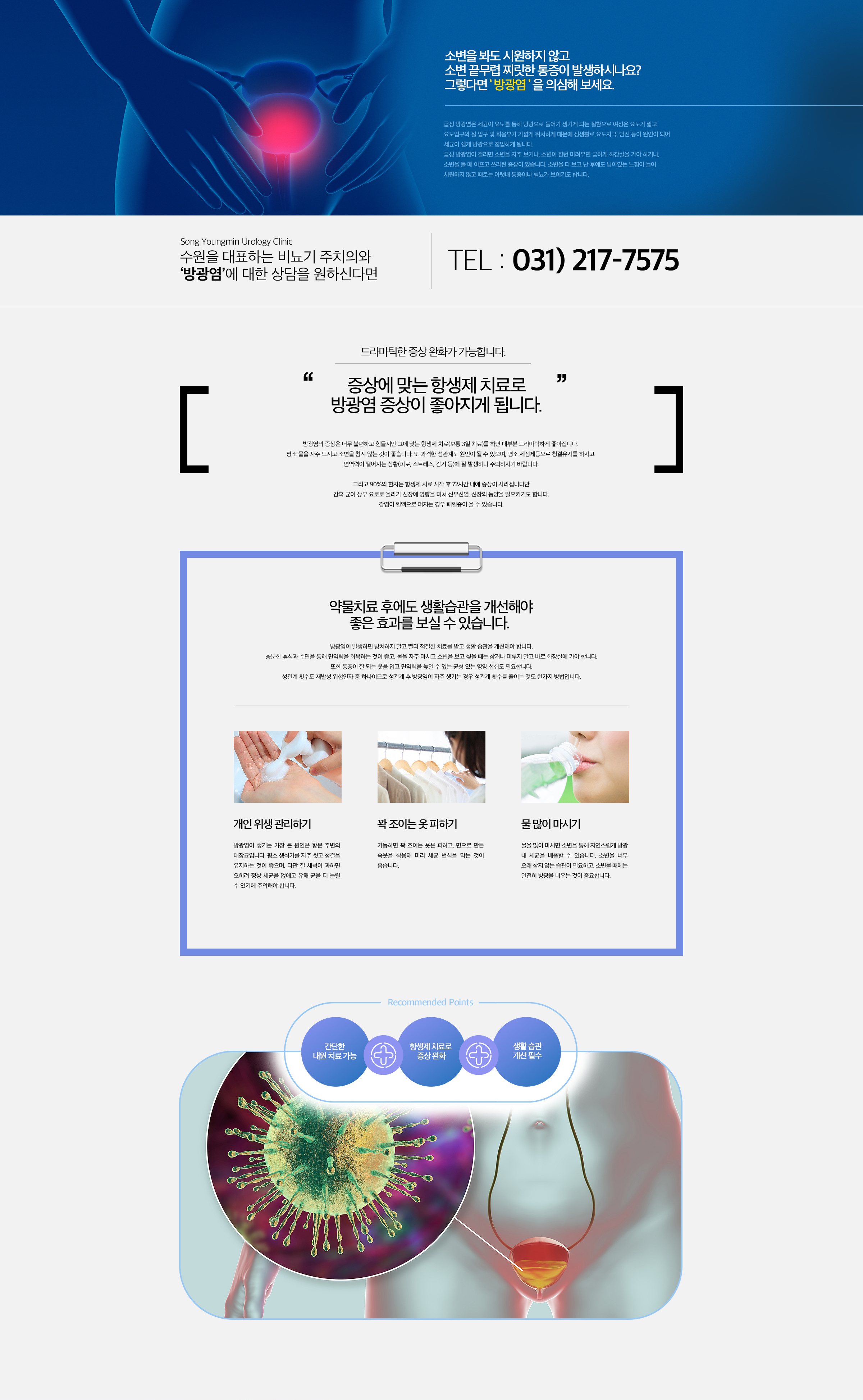 급성 방광염